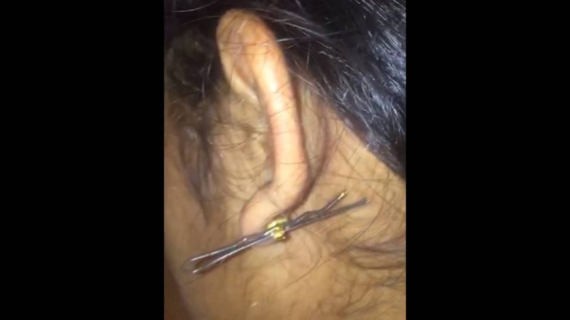 网站改版和页面改版，很多人搞混了